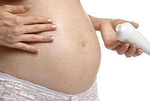 evitar las estrías durante el embarazo